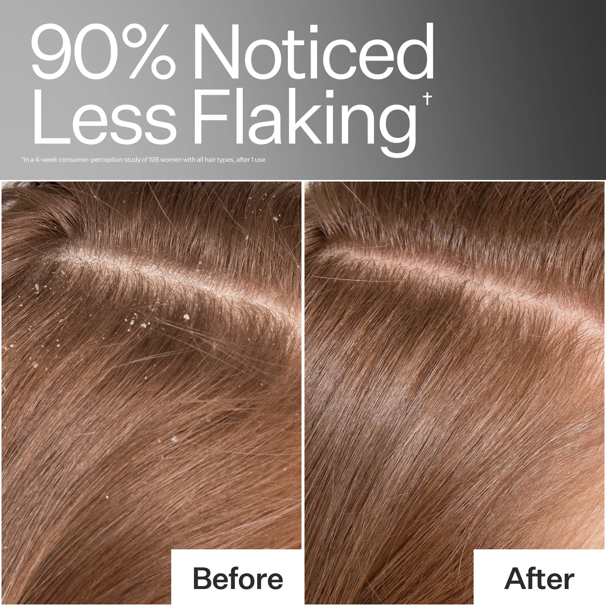 Scalp Detox - Image 5