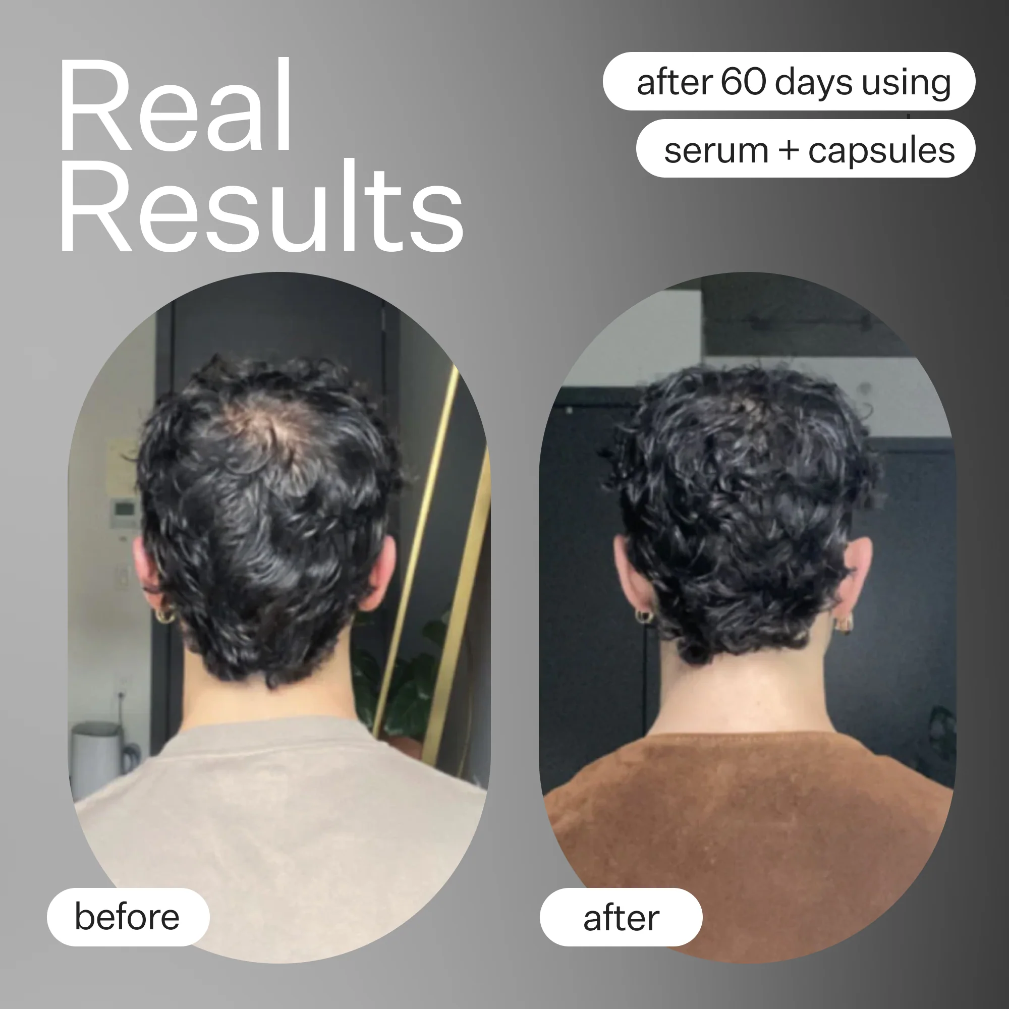 Stem Cell Scalp Serum - Image 4